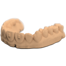 3D打印牙科樹脂